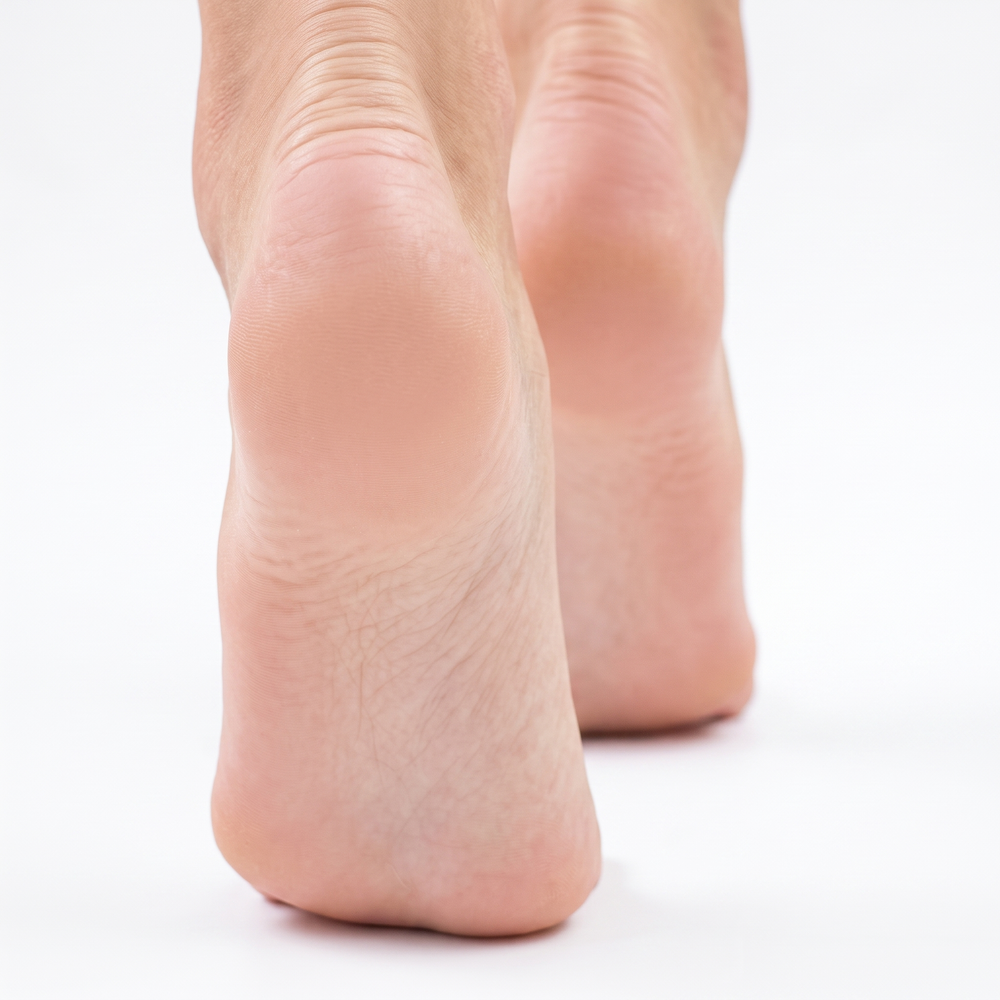 After heel appearance